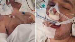 Powiat sztumski. Pomóżmy 18-letniemu Damianowi powrócić do zdrowia.