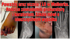 Poważny uraz ucznia I LO w Malborku. Rodzice zawiadomili prokuraturę i kuratorium. Szkoła mówi o nieszczęśliwym wypadku